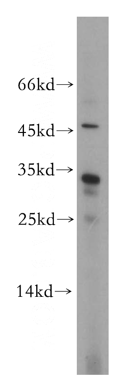 Jurkat cells were subjected to SDS PAGE followed by western blot with Catalog No:109354(CNOT8 antibody) at dilution of 1:400