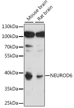 Western blot - NEUROD6 Polyclonal Antibody 