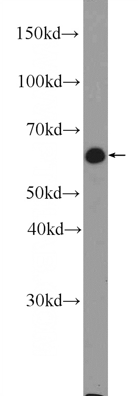 mouse spleen tissue were subjected to SDS PAGE followed by western blot with Catalog No:114770(RNPC3 Antibody) at dilution of 1:300