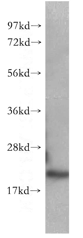 mouse brain tissue were subjected to SDS PAGE followed by western blot with Catalog No:109105(CDC42 antibody) at dilution of 1:400