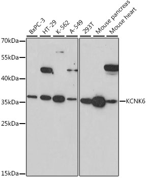 Western blot - KCNK6 Polyclonal Antibody 