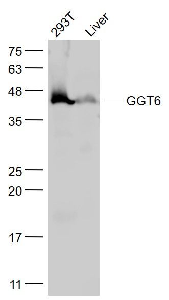 Fig1: Sample:; 293T(Human) Cell Lysate at 30 ug; Liver (Mouse) Lysate at 40 ug; Primary: Anti- GGT6 at 1/1000 dilution; Secondary: IRDye800CW Goat Anti-Rabbit IgG at 1/20000 dilution; Predicted band size: 50 kD; Observed band size: 46 kD