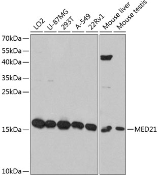 Western blot - MED21 Polyclonal Antibody 