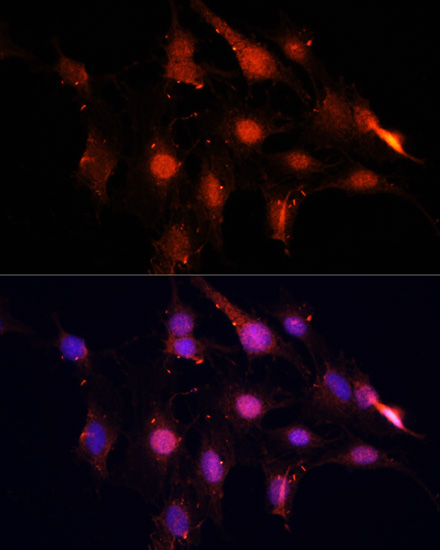 Immunofluorescence - NSUN2 Polyclonal Antibody 