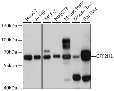 Western blot - GTF2H1 Polyclonal Antibody 