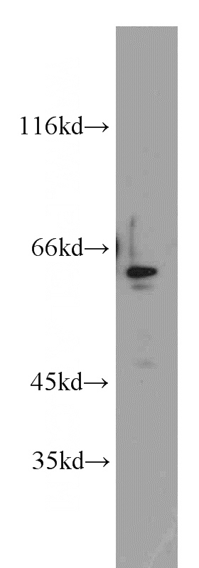 HepG2 cells were subjected to SDS PAGE followed by western blot with Catalog No:117020(ZNF671 antibody) at dilution of 1:500