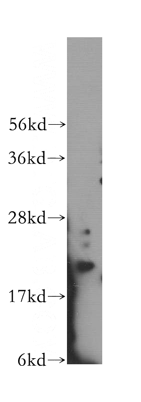 HeLa cells were subjected to SDS PAGE followed by western blot with Catalog No:111758(IMP3 antibody) at dilution of 1:500