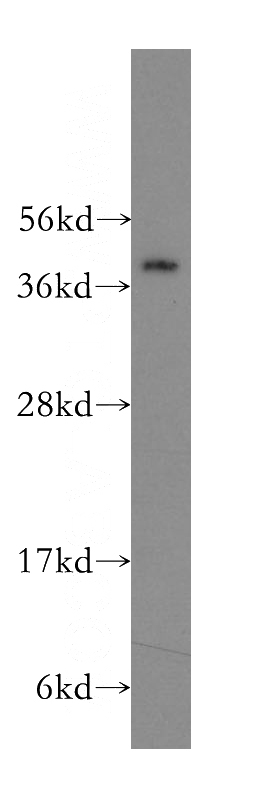 SGC-7901 cells were subjected to SDS PAGE followed by western blot with Catalog No:113406(NUCKS1 antibody) at dilution of 1:400