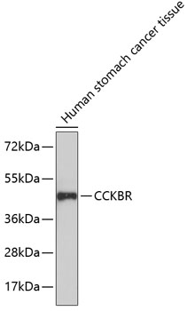Western blot - CCKBR Polyclonal Antibody 
