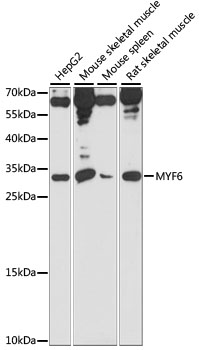 Western blot - MYF6 Polyclonal Antibody 