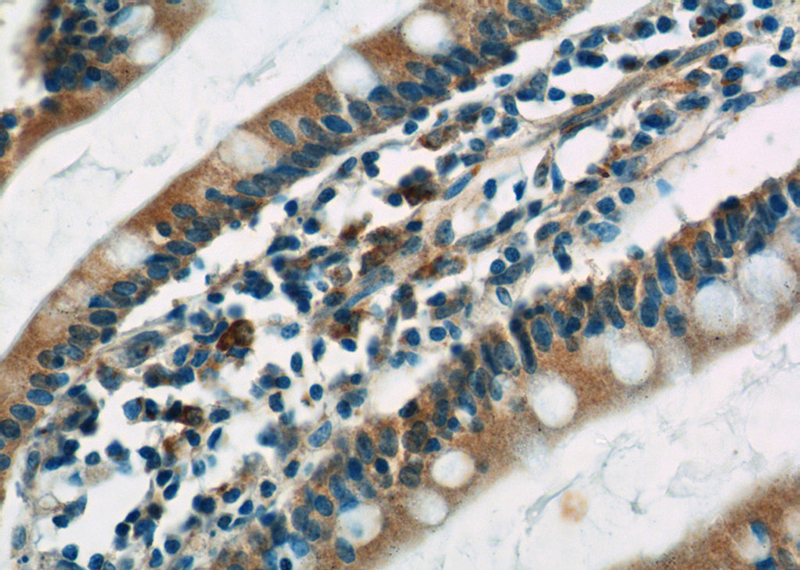 Immunohistochemistry of paraffin-embedded human small intestine tissue slide using Catalog No:108563(C10orf28 Antibody) at dilution of 1:50 (under 40x lens)