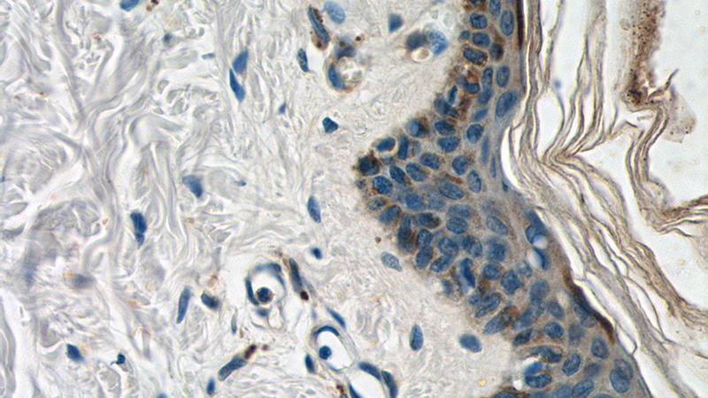 Immunohistochemistry of paraffin-embedded human skin tissue slide using Catalog No:111334(HAL Antibody) at dilution of 1:50 (under 40x lens)