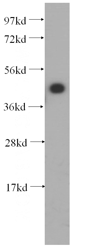 Raji cells were subjected to SDS PAGE followed by western blot with Catalog No:111675(IGBP1 antibody) at dilution of 1:400
