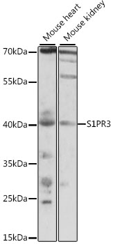 Western blot - S1PR3 Polyclonal Antibody 