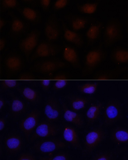 Immunofluorescence - ACADSB Polyclonal Antibody 