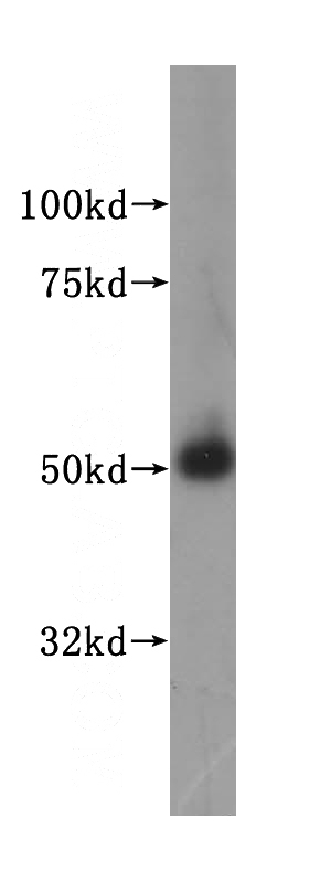 human testis tissue were subjected to SDS PAGE followed by western blot with Catalog No:112689(MLYCD antibody) at dilution of 1:400