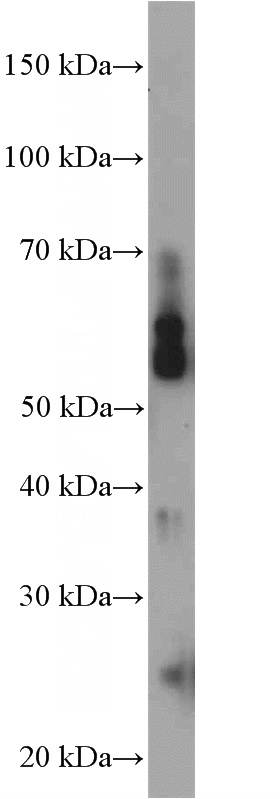 SH-SY5Y cells were subjected to SDS PAGE followed by western blot with Catalog No:113104(NEK3 Antibody) at dilution of 1:300