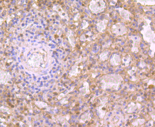 Fig5: Immunohistochemical analysis of paraffin-embedded human spleen tissue using anti-IL19 antibody. Counter stained with hematoxylin.