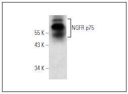 Fig1: Westernblot analysis of NGFR p75 expressionin SK-N-NC whole cell lysate.