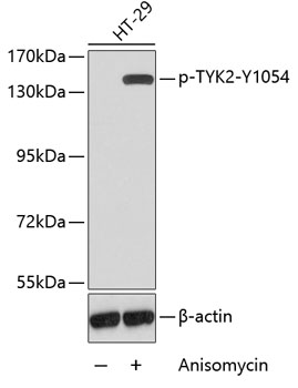 Western blot - Phospho-TYK2-Y1054 pAb 