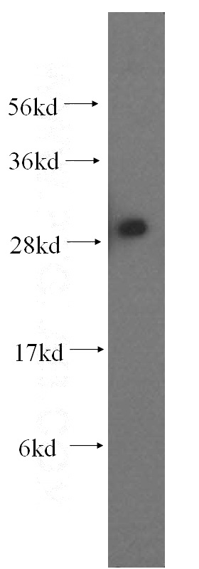 human brain tissue were subjected to SDS PAGE followed by western blot with Catalog No:108104(ANP32A antibody) at dilution of 1:500