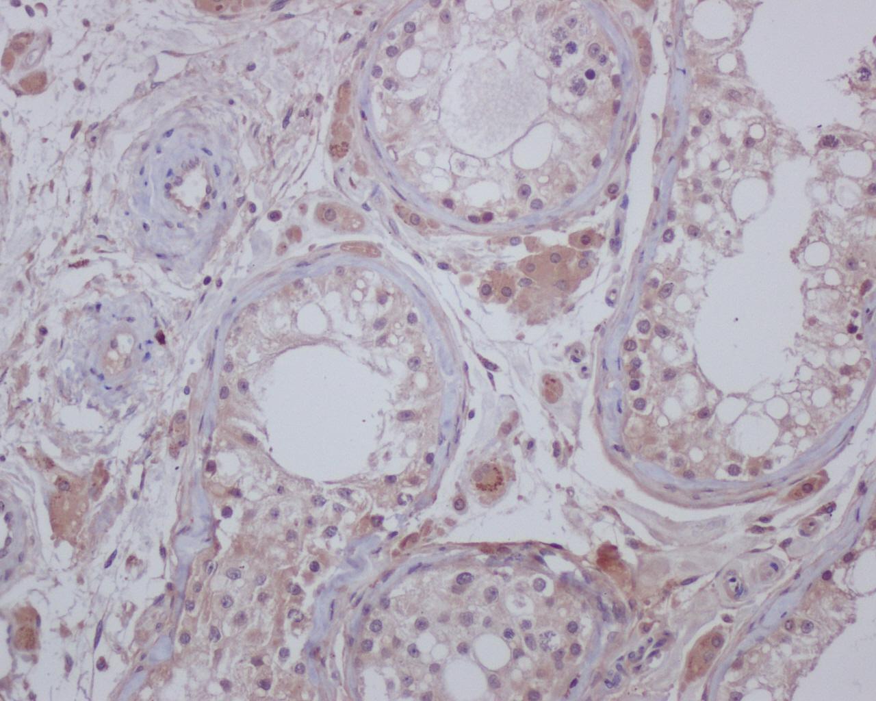 Fig1: Immunohistochemical analysis of paraffin-embedded human testis tissue using anti- C19orf35 mouse mAb.