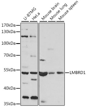 Western blot - LMBRD1 Polyclonal Antibody 