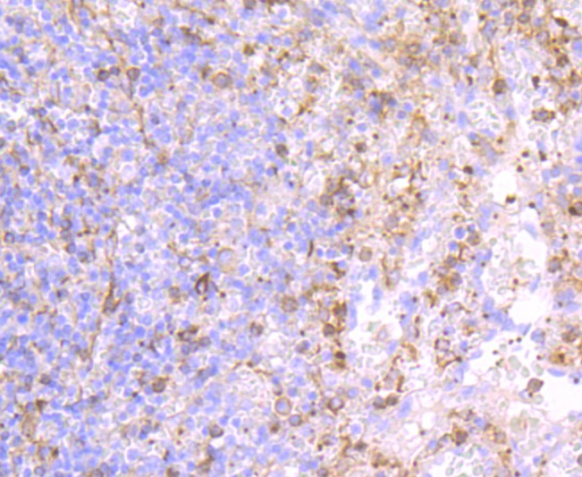Fig3: Immunohistochemical analysis of paraffin-embedded human spleen tissue using anti-CD62P antibody. Counter stained with hematoxylin.
