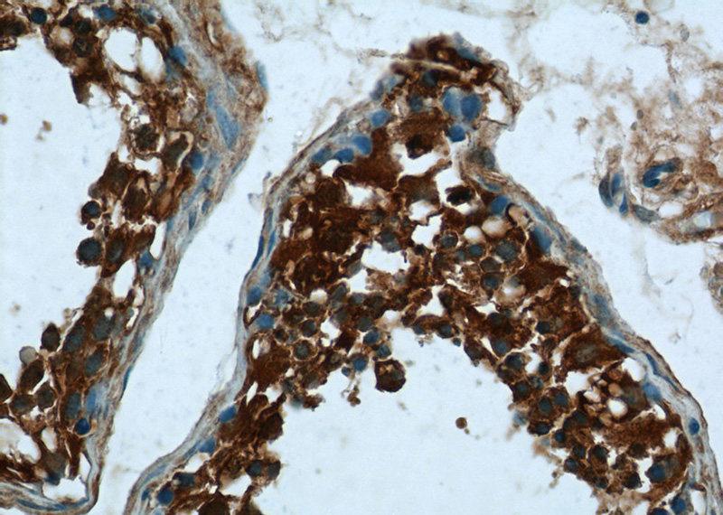 Immunohistochemistry of paraffin-embedded human testis tissue slide using Catalog No:109934(DHX57 Antibody) at dilution of 1:50 (under 40x lens)