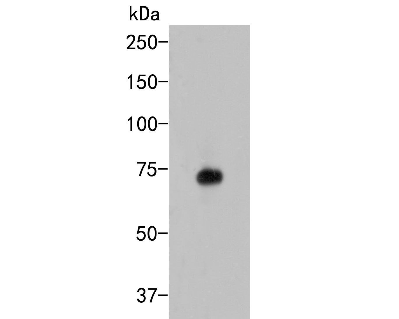Fig1:; Western blot analysis of KCNQ4 on rat kidney tissue lysate. Proteins were transferred to a PVDF membrane and blocked with 5% BSA in PBS for 1 hour at room temperature. The primary antibody ( 1/500) was used in 5% BSA at room temperature for 2 hours. Goat Anti-Rabbit IgG - HRP Secondary Antibody (HA1001) at 1:5,000 dilution was used for 1 hour at room temperature.