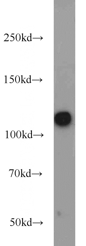 K-562 cells were subjected to SDS PAGE followed by western blot with Catalog No:113587(PARP1 antibody) at dilution of 1:1000