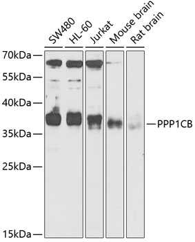 Western blot - PPP1CB Polyclonal Antibody 