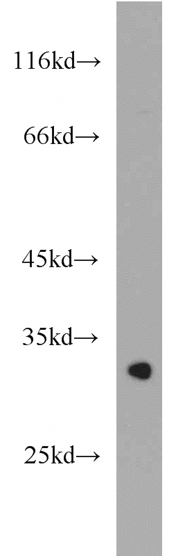 mouse brain tissue were subjected to SDS PAGE followed by western blot with Catalog No:112328(LRRC10 antibody) at dilution of 1:2000