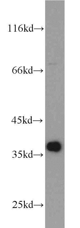 MCF7 cells were subjected to SDS PAGE followed by western blot with Catalog No:117336(PCNA antibody) at dilution of 1:2000
