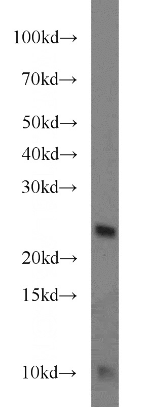HepG2 cells were subjected to SDS PAGE followed by western blot with Catalog No:116086(TMED3 antibody) at dilution of 1:1000