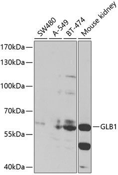 Western blot - GLB1 Polyclonal Antibody 