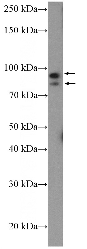 HepG2 cells were subjected to SDS PAGE followed by western blot with Catalog No:117116(BEND3 Antibody) at dilution of 1:600
