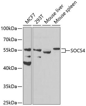 Western blot - SOCS4 Polyclonal Antibody 