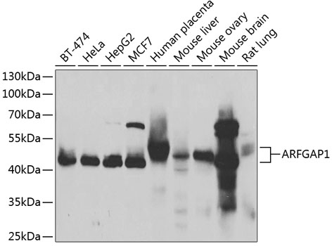 Western blot - ARFGAP1 Polyclonal Antibody 