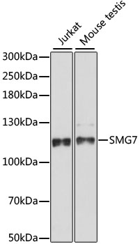 Western blot - SMG7 Polyclonal Antibody 