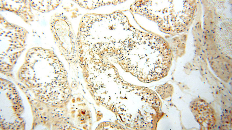 Immunohistochemical of paraffin-embedded human testis using Catalog No:108271(ASS1 antibody) at dilution of 1:100 (under 10x lens)