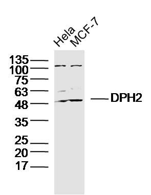 Fig1: Sample:; Hela Cell (Human) Lysate at 30 ug; MCF-7Cell (Human) Lysate at 30 ug; Primary: Anti-DPH2 at 1/300 dilution; Secondary: IRDye800CW Goat Anti-Rabbit IgG at 1/20000 dilution; Predicted band size: 52kD; Observed band size: 52kD