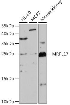 Western blot - MRPL17 Polyclonal Antibody 