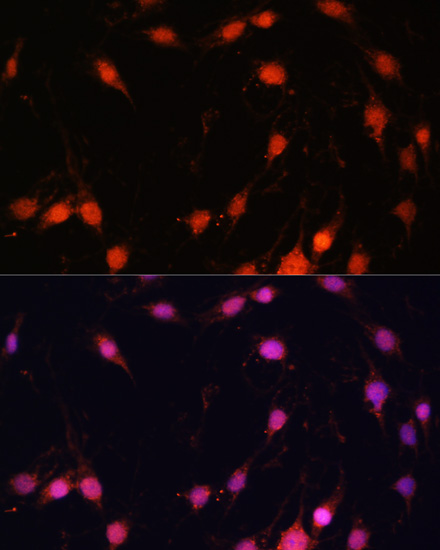 Immunofluorescence - ZNF416 Polyclonal Antibody 