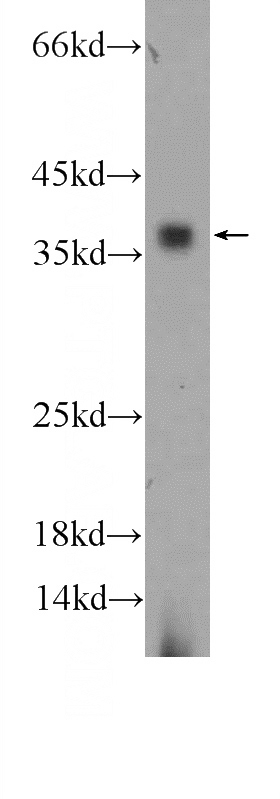mouse colon tissue were subjected to SDS PAGE followed by western blot with Catalog No:110718(FPGT Antibody) at dilution of 1:600