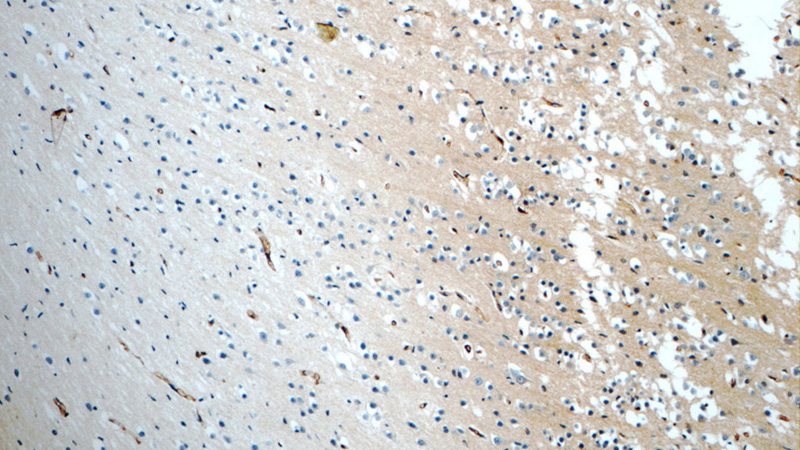 Immunohistochemistry of paraffin-embedded human brain tissue slide using Catalog No:113731(PEX5L Antibody) at dilution of 1:50 (under 10x lens)