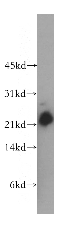 human brain tissue were subjected to SDS PAGE followed by western blot with Catalog No:114437(RAB39 antibody) at dilution of 1:500