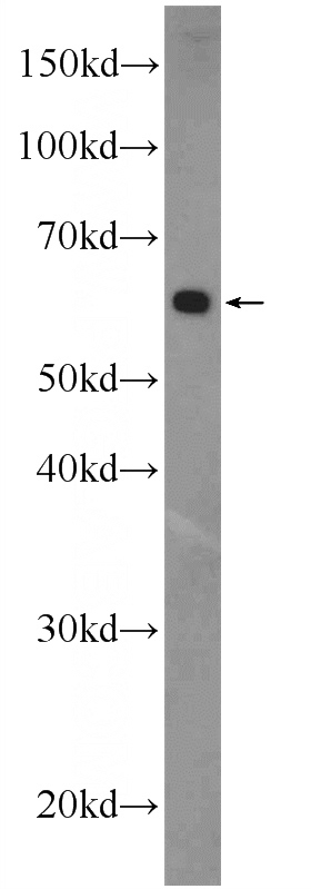 MDA-MB-453s cells were subjected to SDS PAGE followed by western blot with Catalog No:111216(GRN1/G Antibody) at dilution of 1:600