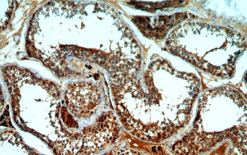 Immunohistochemical of paraffin-embedded human testis using Catalog No:109930(DHX32 antibody) at dilution of 1:100 (under 10x lens)
