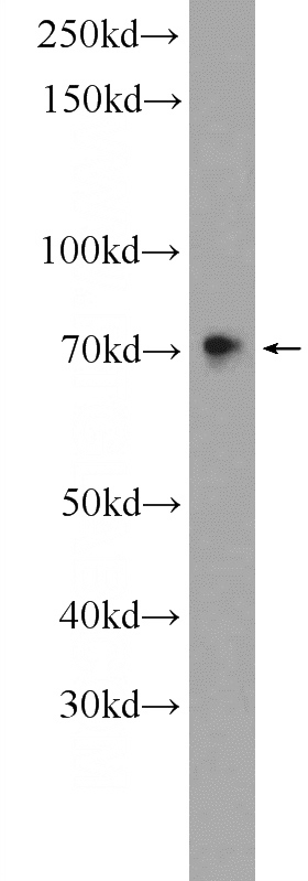 HEK-293 cells were subjected to SDS PAGE followed by western blot with Catalog No:115050(SAMD11 Antibody) at dilution of 1:600